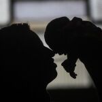 Un bebé nacido con microcefalia a causa del zika