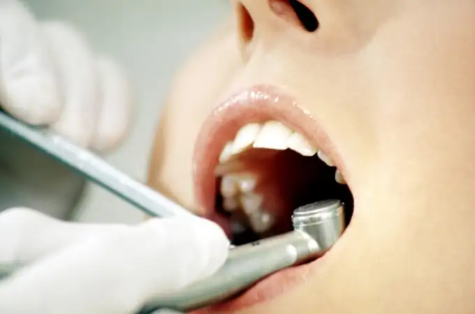 Sanidad alerta sobre estos implantes dentales falsificados