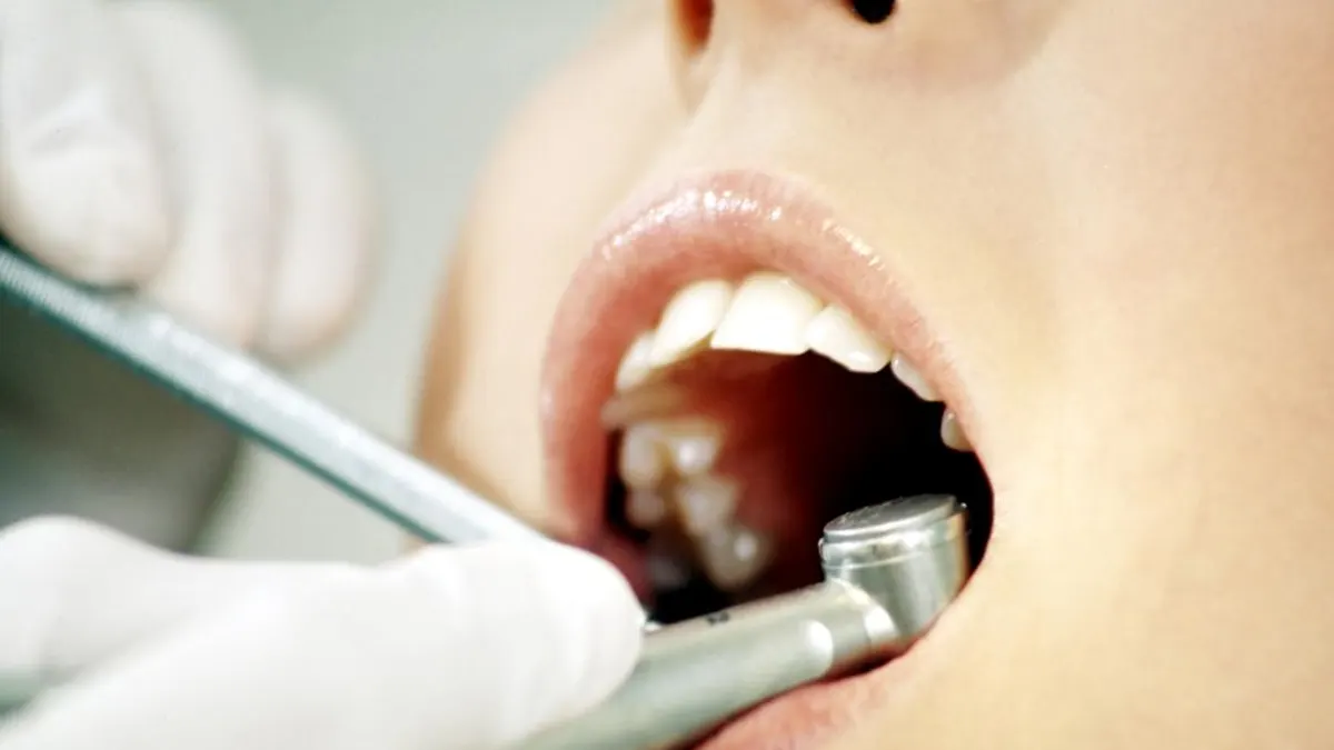 Sanidad alerta sobre estos implantes dentales falsificados