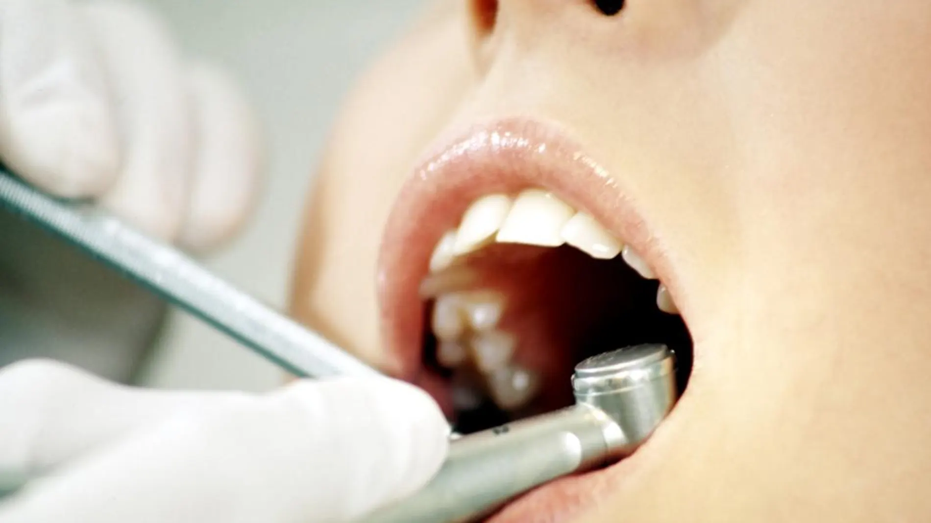 Desarrollan implantes dentales con actividad antibacteriana