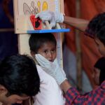 Enfermeros hacen un control médico a un niño rohinyá que sufre desnutrición en el campo de refugiados de Balukhali en el distrito de Cox's Bazar, Bangladesh
