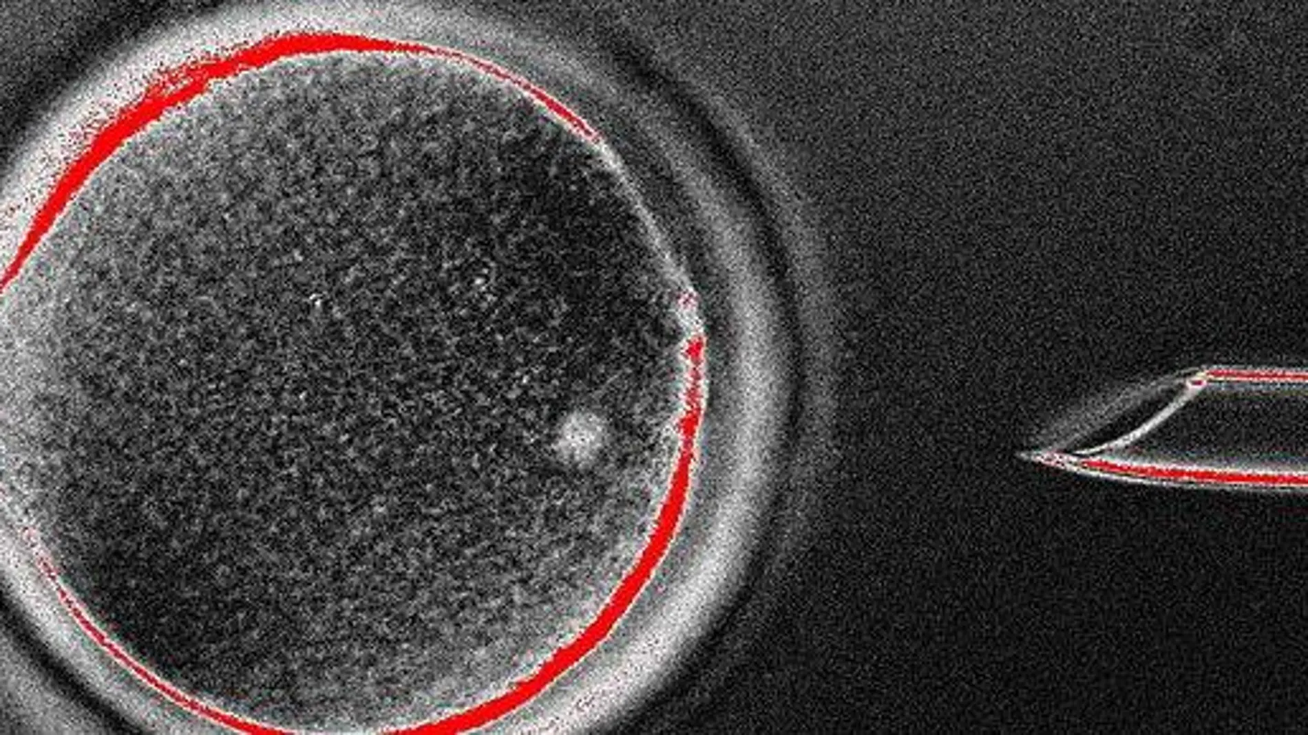 El óvulo antes de la extracción nuclear