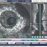 Las imágenes recogidas configuran mapas visuales que permiten al clínico guiar los instrumentos a través del cuerpo