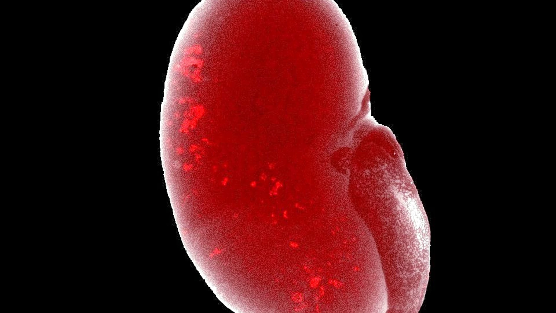 Ilustración de archivo de un riñón