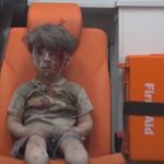 El horror de Alepo en la cara de Omran