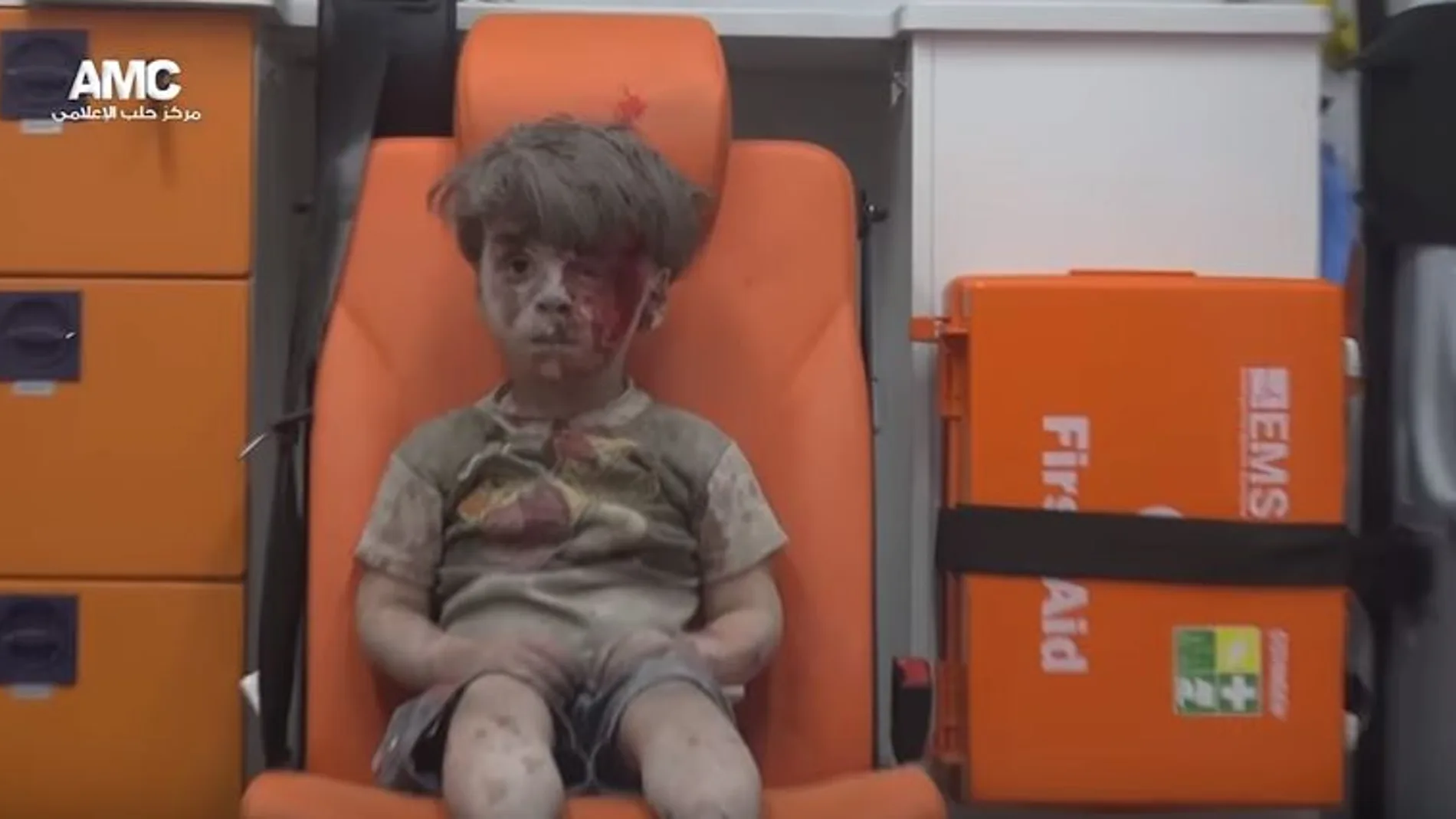 El horror de Alepo en la cara de Omran