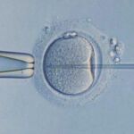 Un hospital holandés podría haber inseminado a 26 mujeres con esperma erróneo