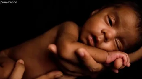 Imagen de uno de los niños que ha logrado sobrevivir gracias a UNICEF