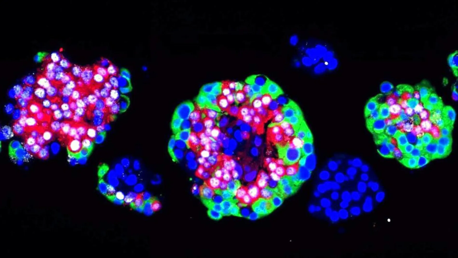 La artemisinina podría utilizarse para reemplazar las células beta destruidas del páncreas del diabético y sustituirlas con nuevas células productoras de insulina