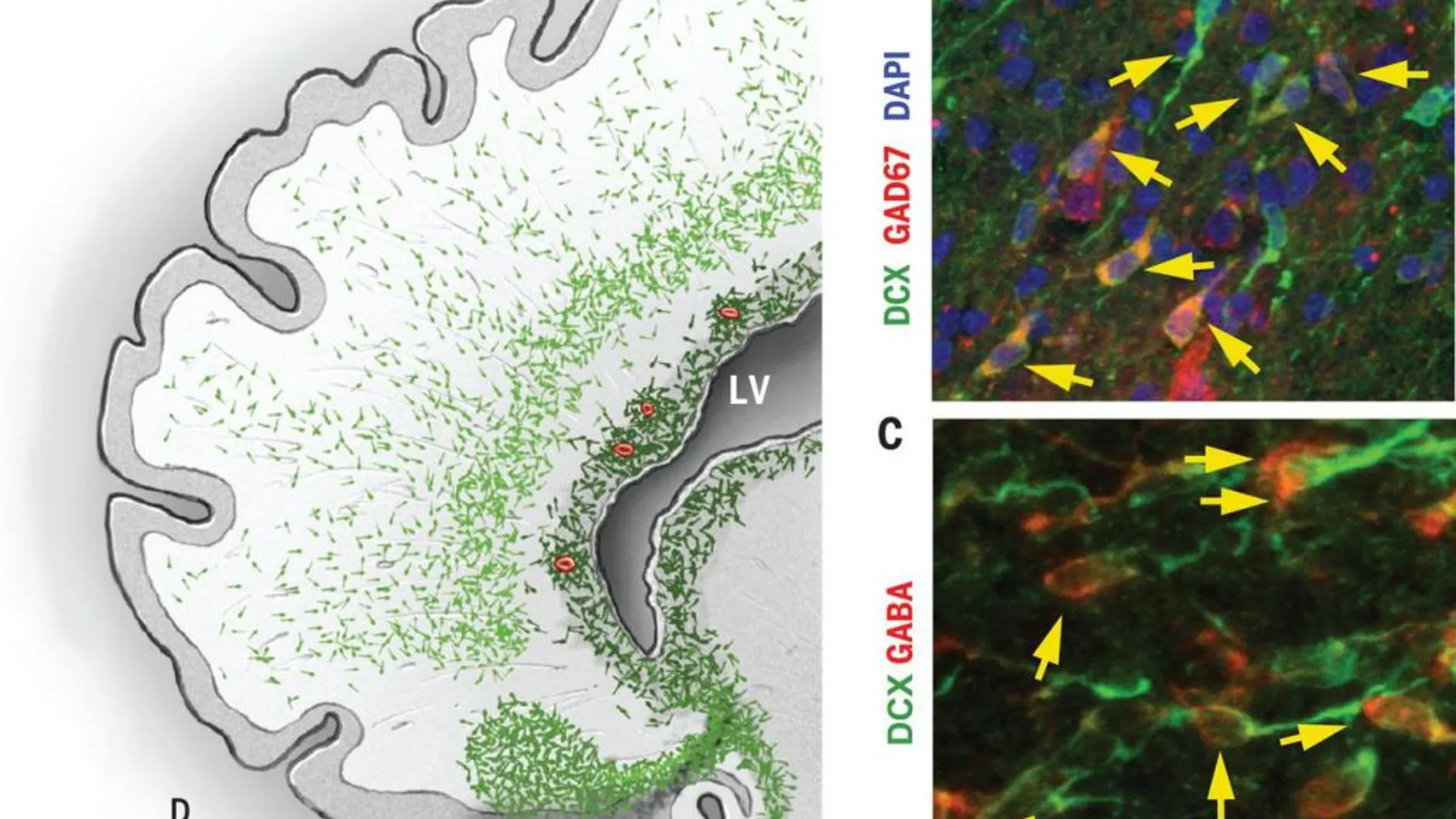 Descubren un posible origen de la epilepsia y el autismo