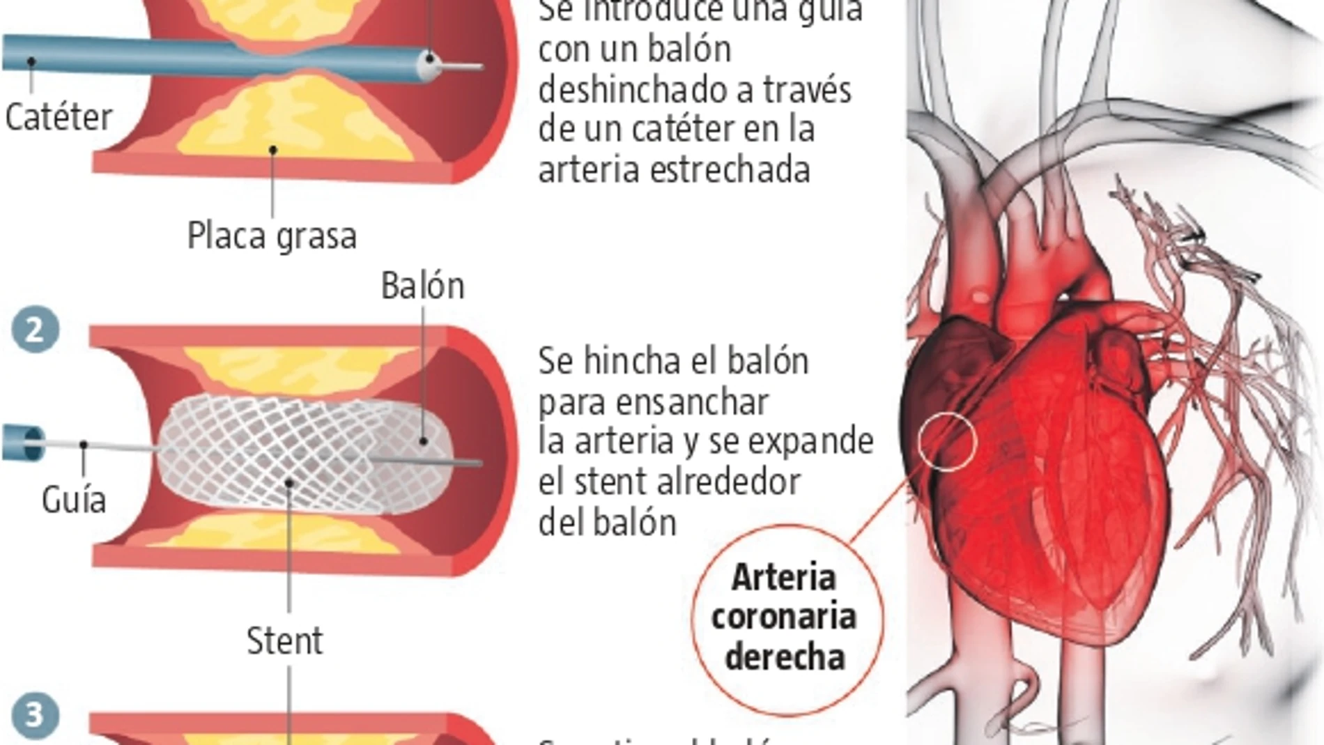 "Recomendaría a Casillas que se retirara"