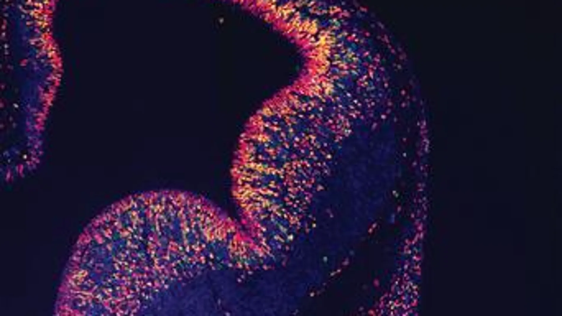 Imagen de la portada de "Journal of Neuroscience"