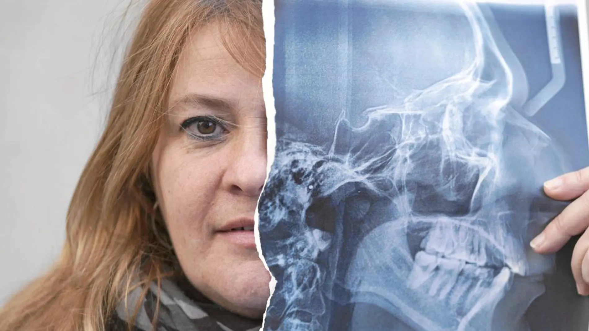Carmen sostiene una radiografía de laringe