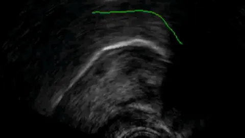 Imagen del movimiento de la lengua obtenida durante los experimentos