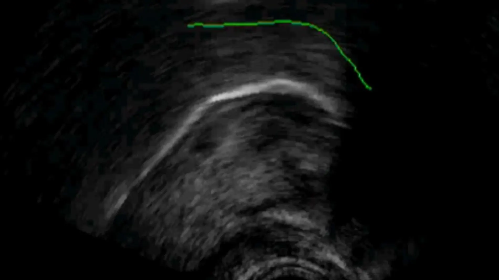 Imagen del movimiento de la lengua obtenida durante los experimentos