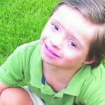 Niños con síndrome de Down, alegría y nexo de unión de las familias