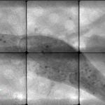 EPC visualizada en el microscopio de transmisión de rayos X del Sincrotrón ALBA