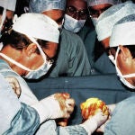 Primer trasplante de corazón en 1989