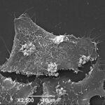 Micrografía electrónica de barrido de las células HeLa infectadas in vitro con bacterias atenuadas EPEC