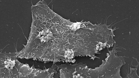 Micrografía electrónica de barrido de las células HeLa infectadas in vitro con bacterias atenuadas EPEC