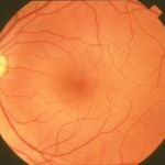 La retina humana