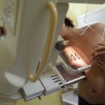 El fármaco que frena la metástasis de mama llega a la Sanidad española