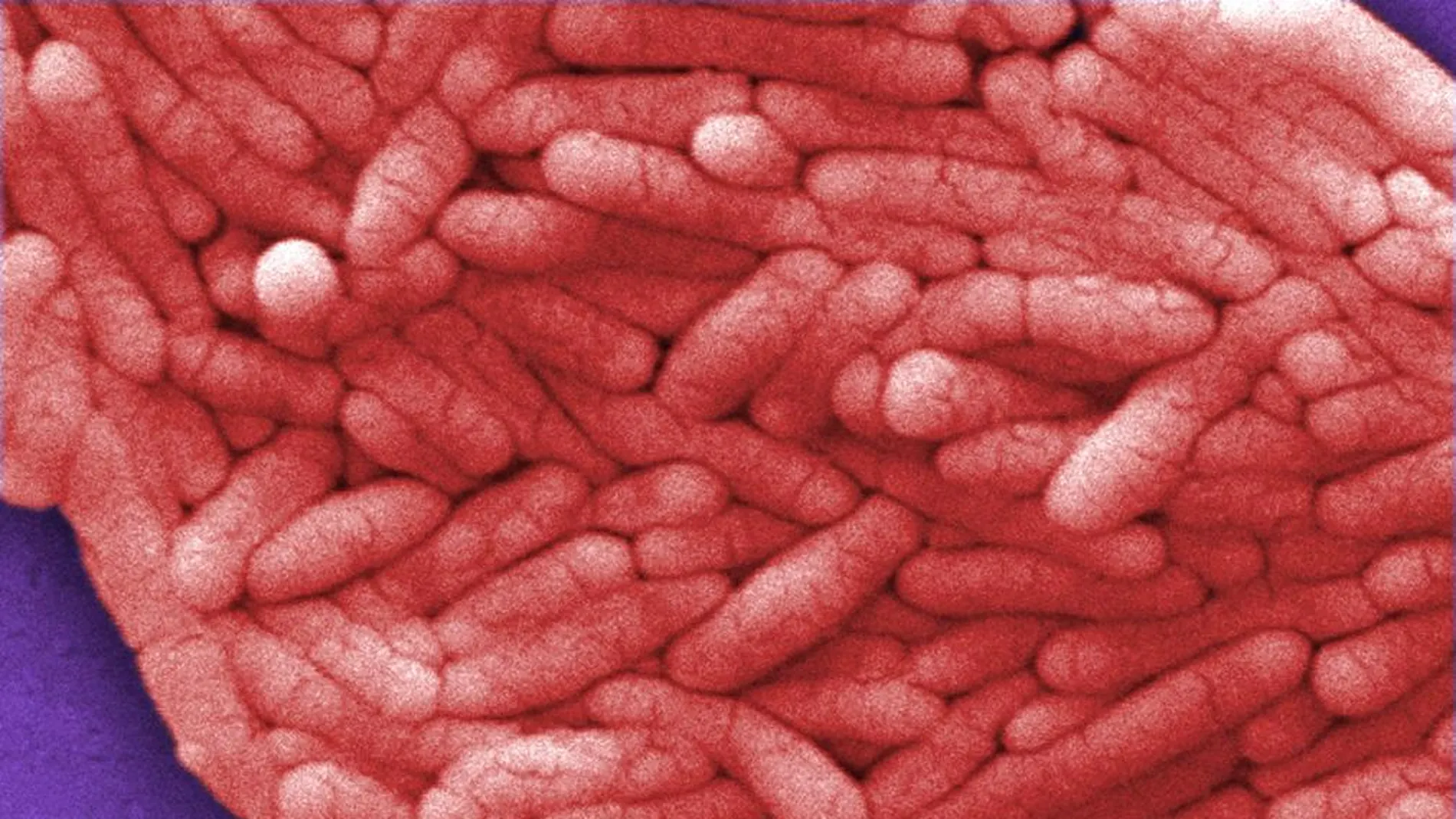Bacteria de la salmonella