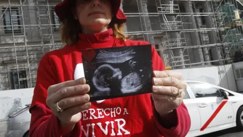 Una de las voluntarias de Derecho a Vivir muestra una ecografía a las puertas del Congreso