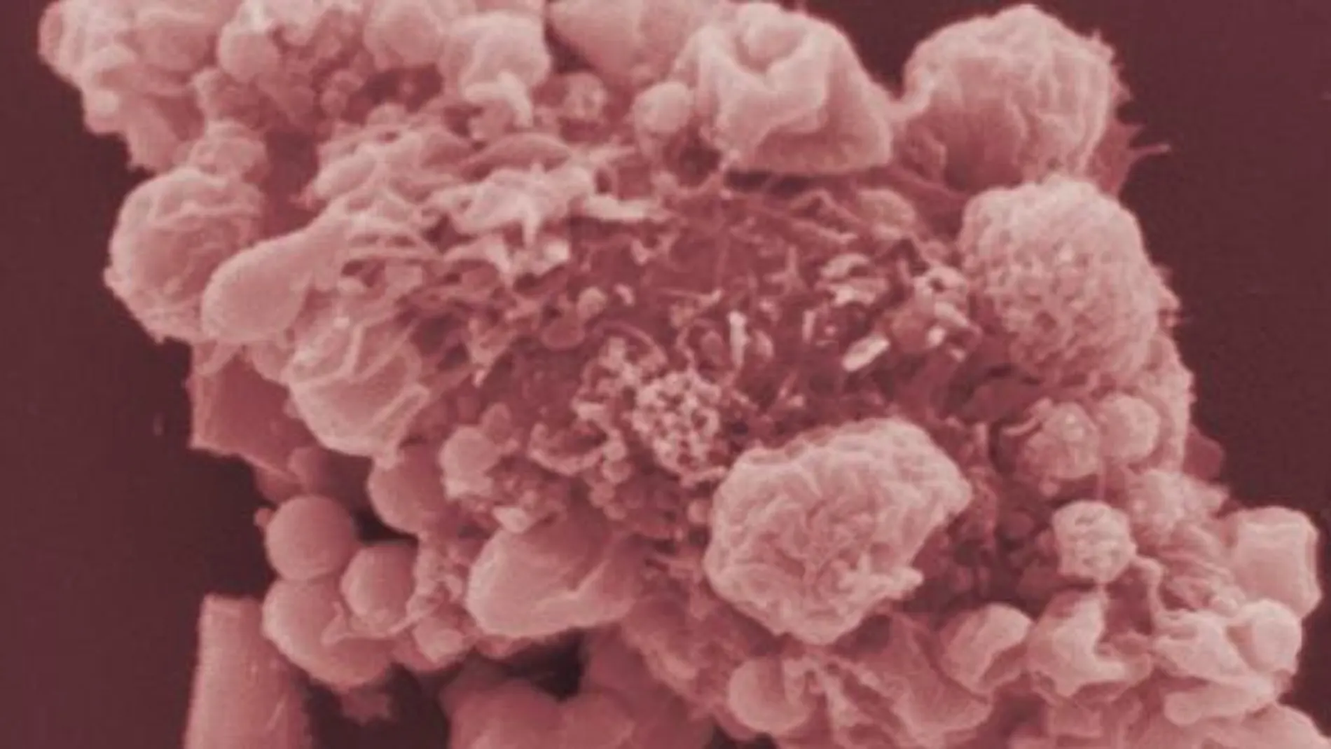 Composición de imágenes microscópicas de células cancerígenas.