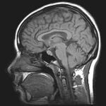 Imagen IRM de un escáner cerebral