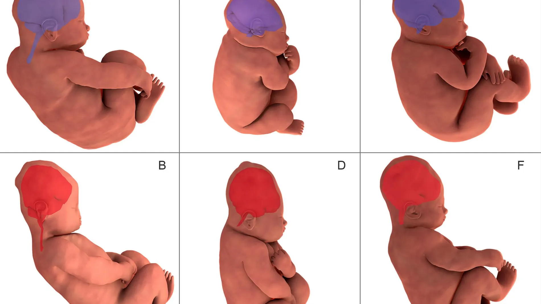 Reconstrucción tridimensional de los huesos craneales antes del parto y durante la segunda parte del mismo. / Ami et al