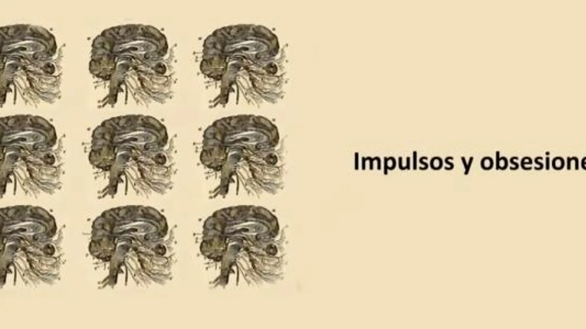 Fotograma del documental "El mal del cerebro", emitido en el marco de un proyecto del departamento de Neurociencia de la Universidad de Barcelona