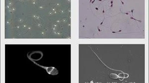 Imágenes de espermatozoides