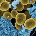 Staphylococcus aureus escapando de la destrucción por leucocitos humanos