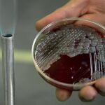 Una muestra con la bacteria del ántrax, en una imagen de archivo