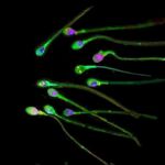 Espermatozoides analizados al microscopio
