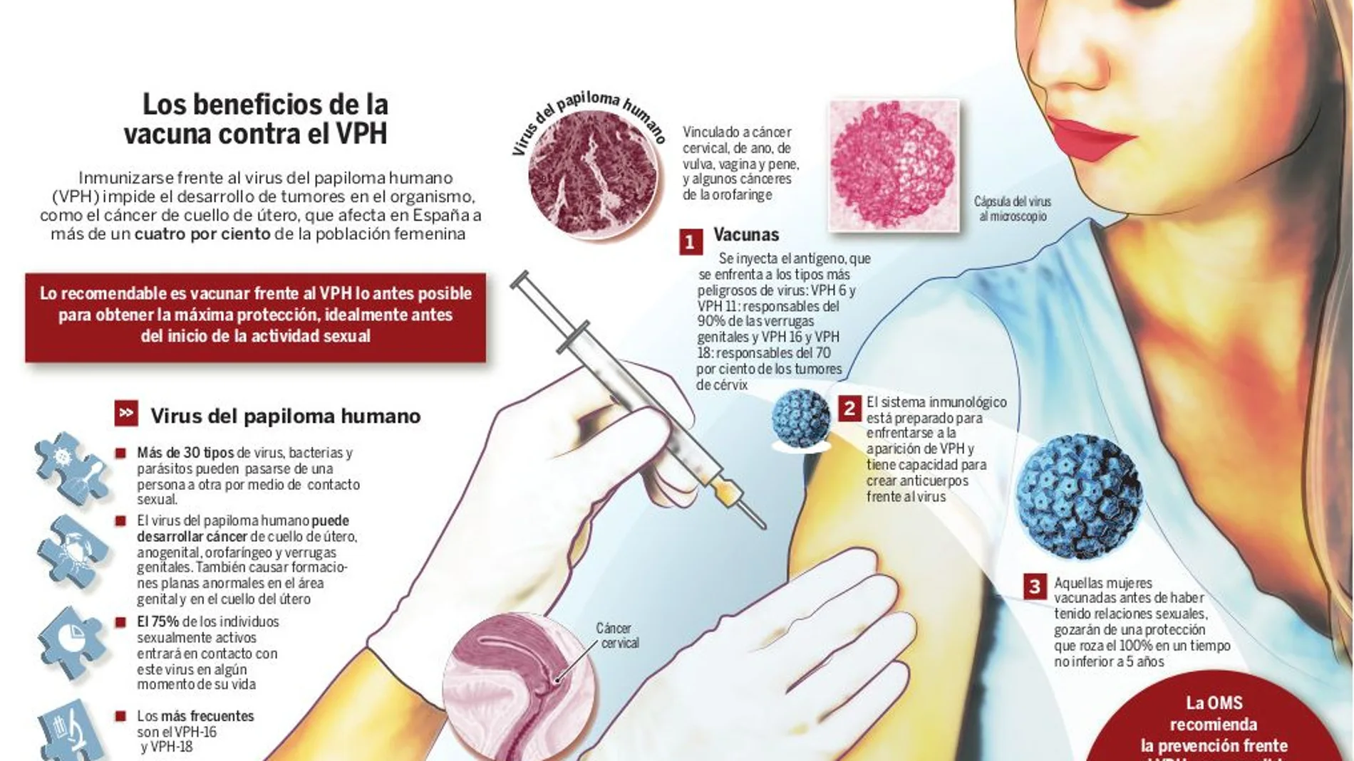 El virus del papiloma humano estará erradicado en 30 años