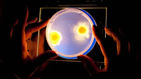 Mycobacterium colombiense