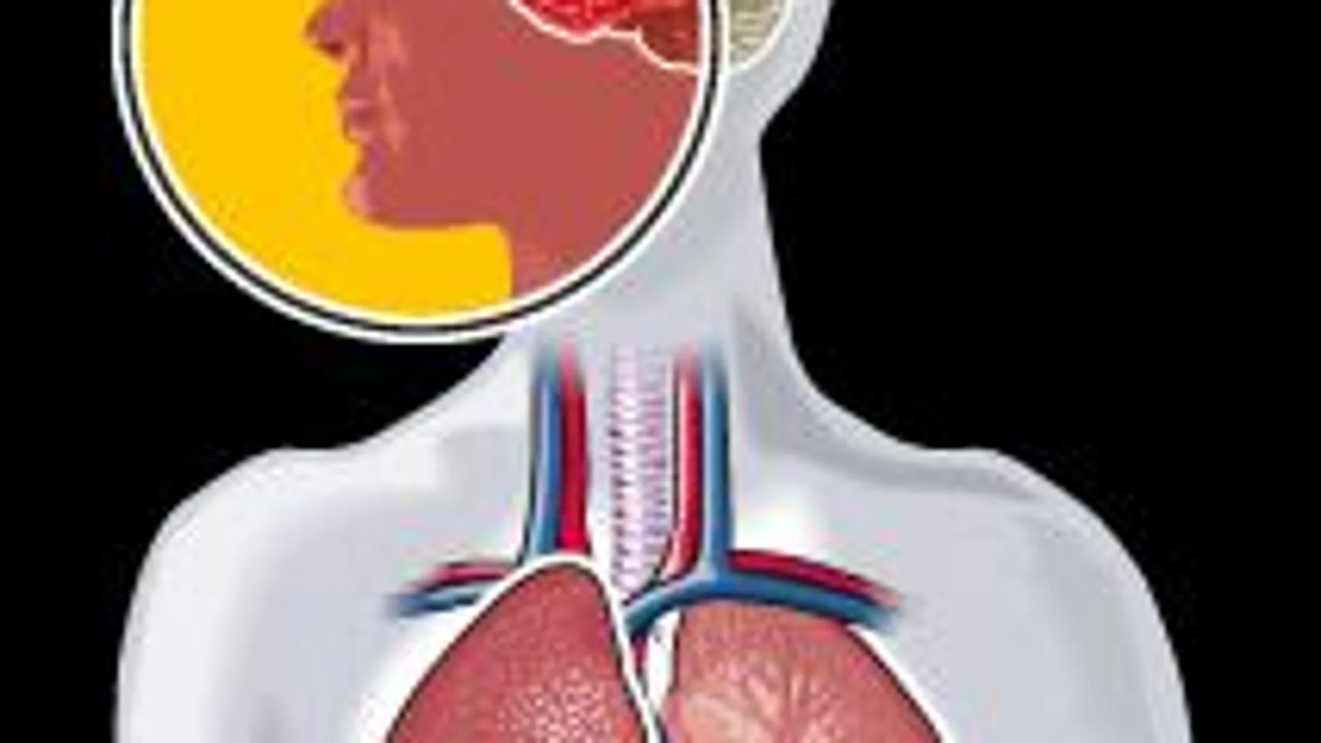 ¿Por qué es tan letal el ébola?