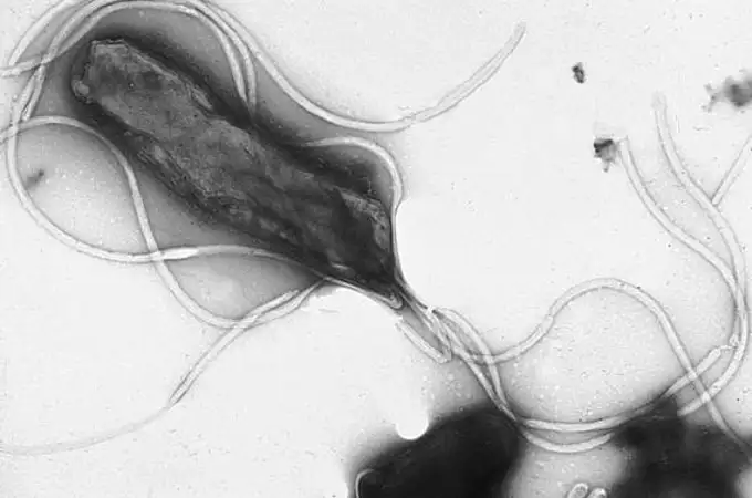 La infección por Helicobacter pylori aumenta el riesgo de alzhéimer un 11% en mayores de 50 