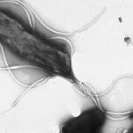La bacteria Helicobacter pylori