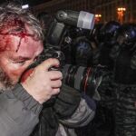 Un fotógrafo resulta herido en la carga policial