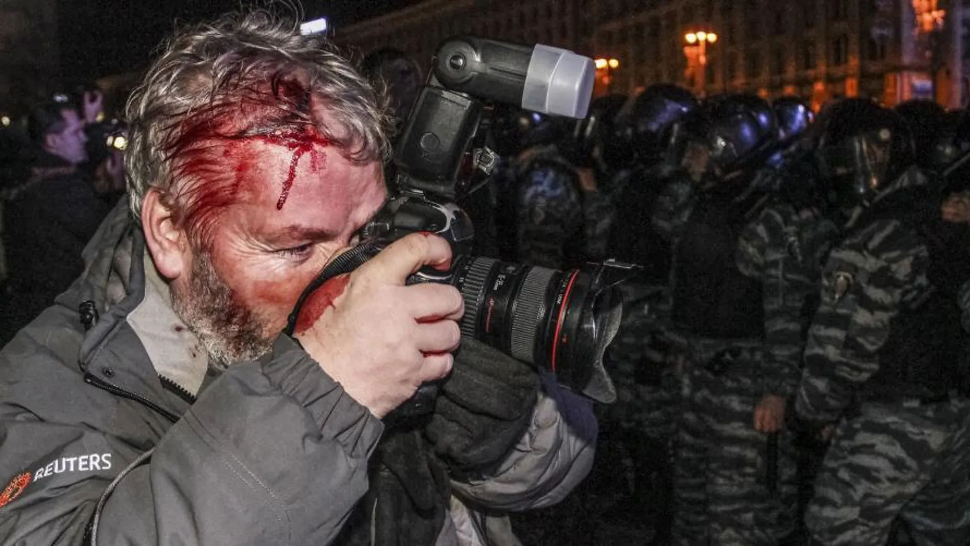 Un fotógrafo resulta herido en la carga policial