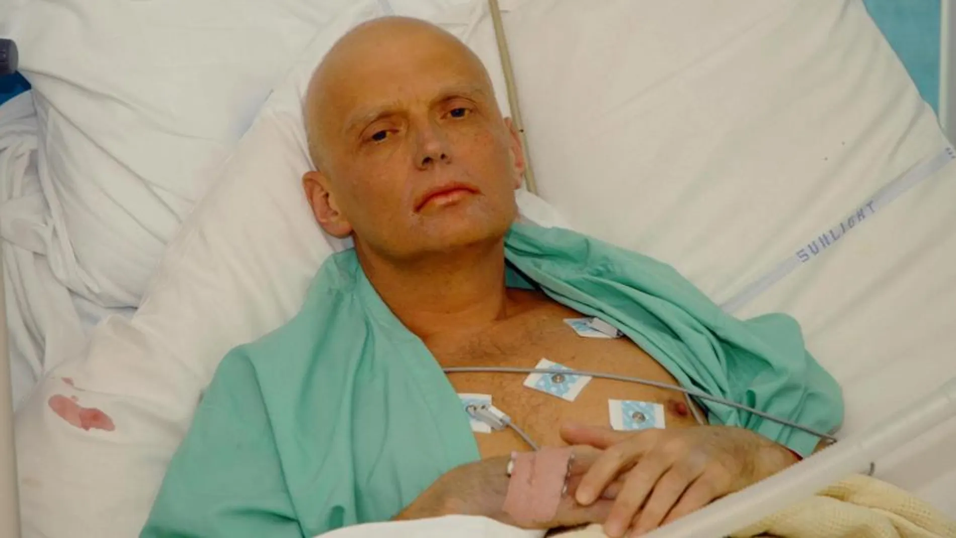 El ex espía Alexander Litvinenko en 2006, poco antes de morir, en Londres tras ser envenenado con polonio