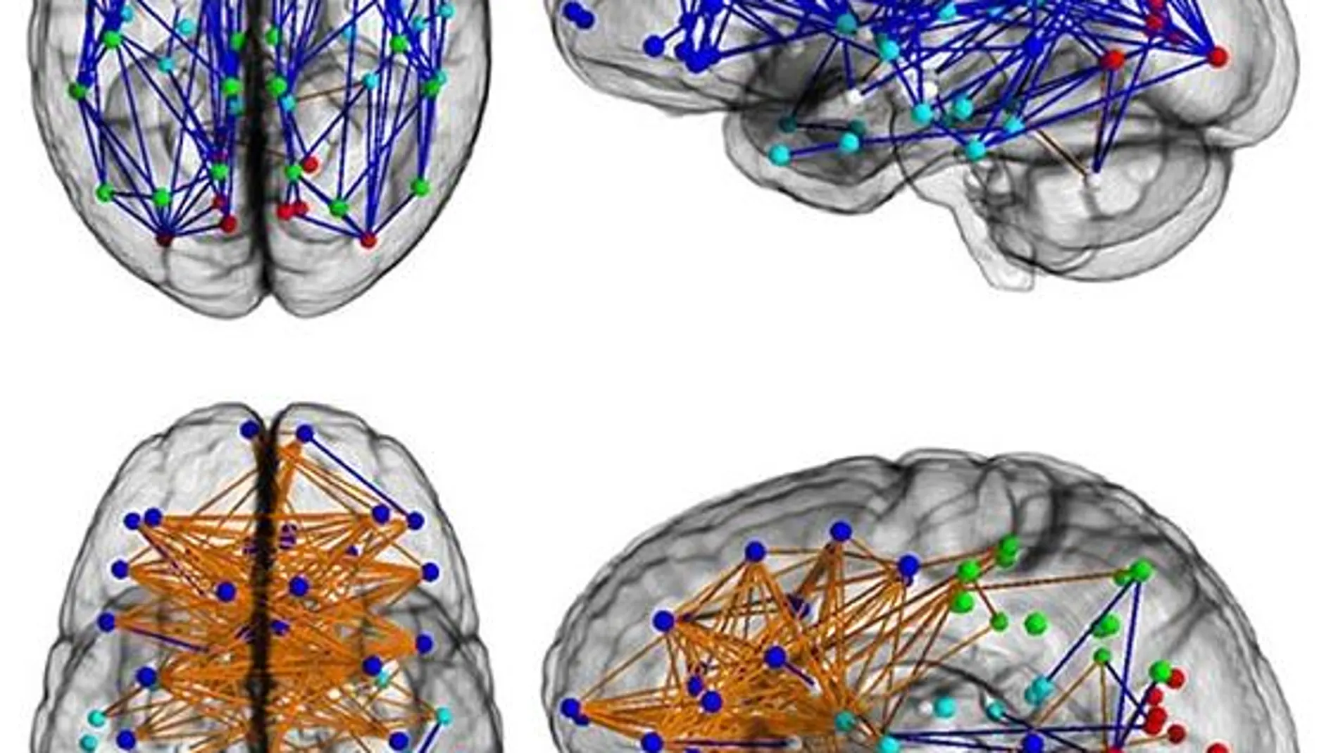 Imagen con las conexiones cerebrales de hombres (arriba) y mujeres (abajo)