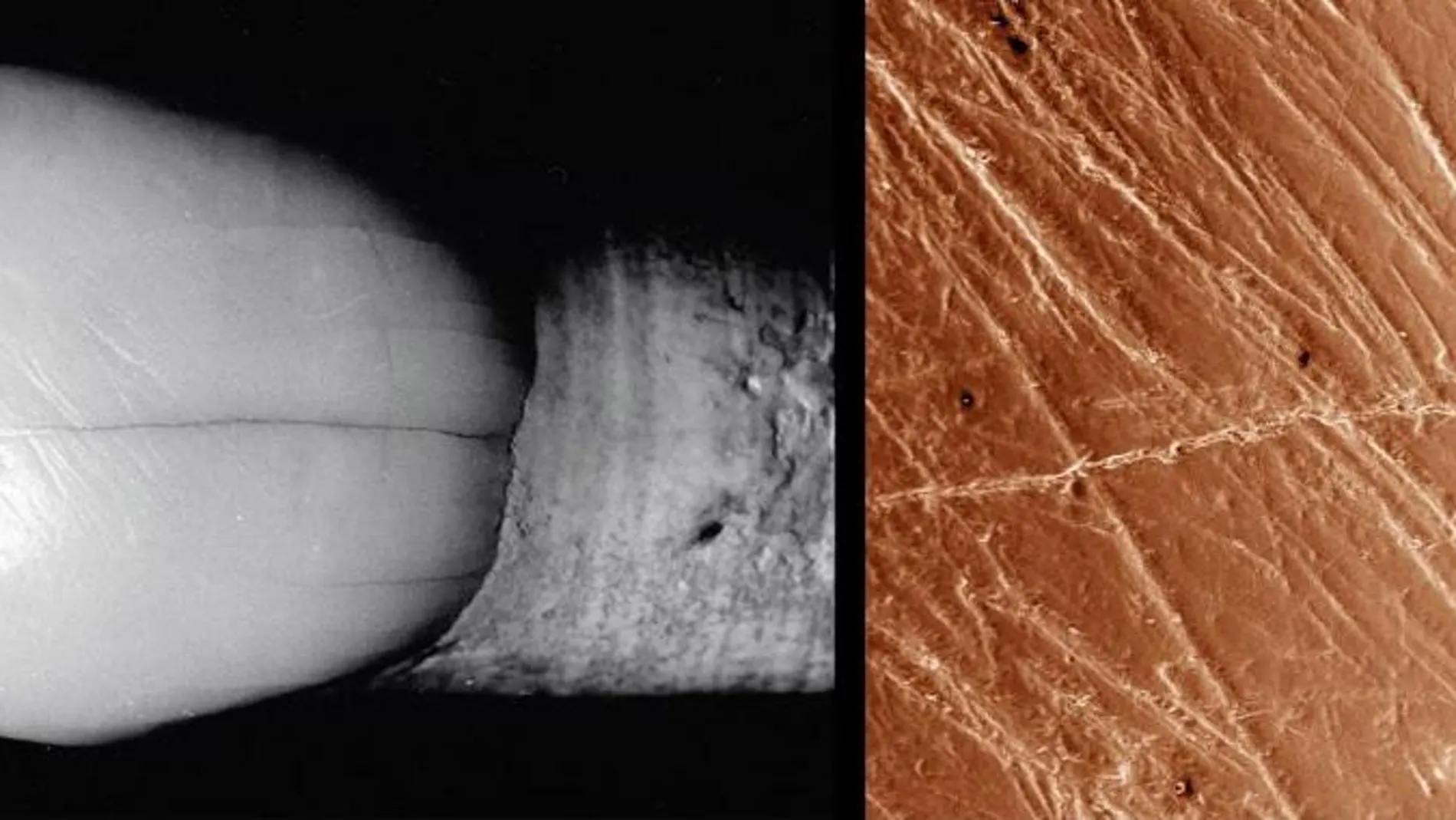Estrías labiales en un incisivo superior del Individuo II de la Sima de los Huesos, visualizadas con microscopio electrónico de barrido