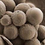 Imagen de varias bacterias