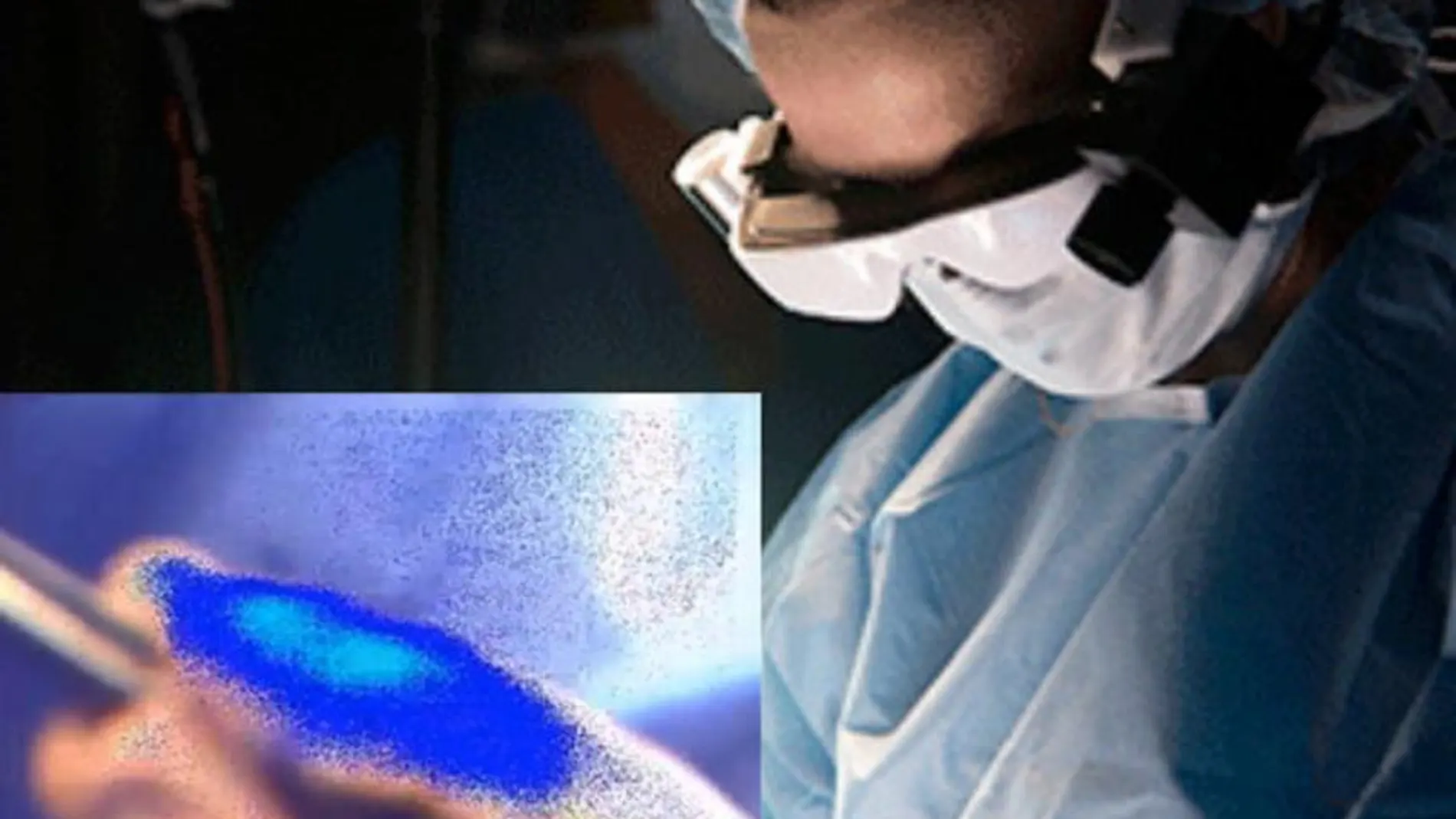 Las gafas de tecnología punta permiten a la cirujana Julie Margenthaler visualizar las células cancerígenas de su paciente, en plena operación.