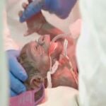 Nace por cesárea una bebé gorila en el zoo de San Diego