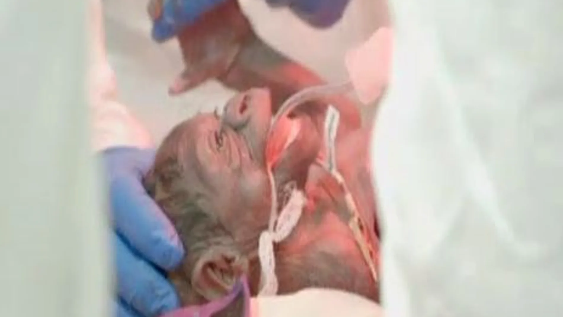 Nace por cesárea una bebé gorila en el zoo de San Diego